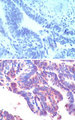 IFRD1 / TIS7 Antibody - IHC of Tis7 in formalin-fixed, paraffin-embedded human rectum tissue using an isotype control (top) and Polyclonal Antibody to Tis7 (bottom) at 5 ug/ml.