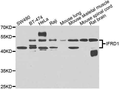 IFRD1 / TIS7 Antibody - Western blot analysis of extracts of various cell lines.