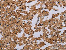IFRD1 / TIS7 Antibody - Immunohistochemistry of paraffin-embedded Human brain using IFRD1 Polyclonal Antibody at dilution of 1:40.