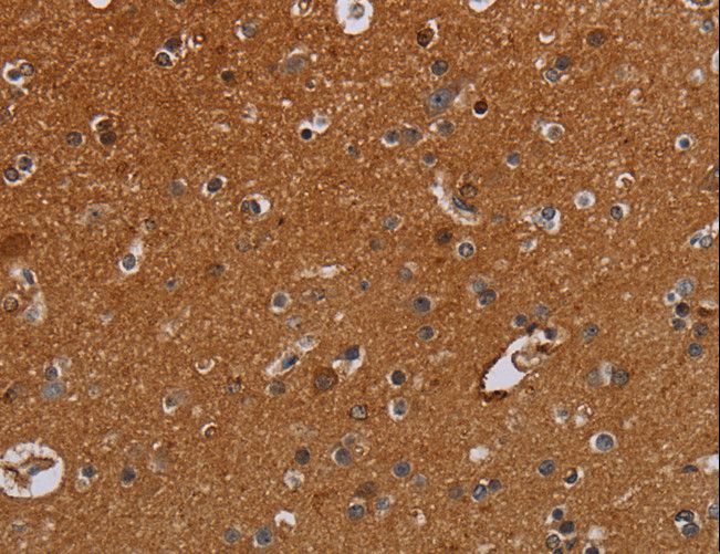 IFRD1 / TIS7 Antibody - Immunohistochemistry of paraffin-embedded Human brain using IFRD1 Polyclonal Antibody at dilution of 1:30.