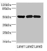 IFRD1 / TIS7 Antibody - Western blot All Lanes: IFRD1 antibody at 1.76ug/ml Lane 1: Mouse skeletal muscle tissue Lane 2: Hela whole cell lysate Lane 3: Jurkat whole cell lysate Secondary Goat polyclonal to Rabbit IgG at 1/10000 dilution Predicted band size: 51,46 kDa Observed band size: 50 kDa