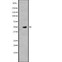 IFRD1 / TIS7 Antibody - Western blot analysis of IFRD1 expression in HeLa cells lysate. The lane on the left is treated with the antigen-specific peptide.