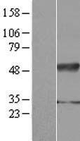 IFRD2 Protein - Western validation with an anti-DDK antibody * L: Control HEK293 lysate R: Over-expression lysate