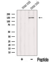 IFT122 / WDR10 Antibody - Western blot analysis of extracts of mouse testis tissue using IFT122 antibody. The lane on the left was treated with blocking peptide.