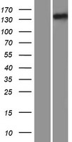 IFT122 / WDR10 Protein - Western validation with an anti-DDK antibody * L: Control HEK293 lysate R: Over-expression lysate