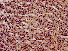 IFT140 Antibody - Immunohistochemistry Dilution at 1:300 and staining in paraffin-embedded human adrenal gland tissue performed on a Leica BondTM system. After dewaxing and hydration, antigen retrieval was mediated by high pressure in a citrate buffer (pH 6.0). Section was blocked with 10% normal Goat serum 30min at RT. Then primary antibody (1% BSA) was incubated at 4°C overnight. The primary is detected by a biotinylated Secondary antibody and visualized using an HRP conjugated SP system.