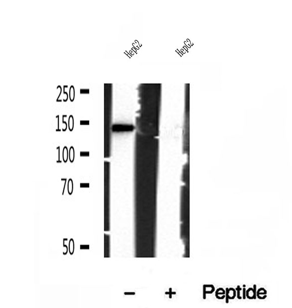 IFT140 Antibody - Western blot analysis of extracts of HepG2 cells using IFT140 antibody.