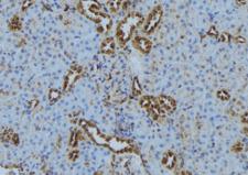 IFT140 Antibody - 1:100 staining mouse kidney tissue by IHC-P. The sample was formaldehyde fixed and a heat mediated antigen retrieval step in citrate buffer was performed. The sample was then blocked and incubated with the antibody for 1.5 hours at 22°C. An HRP conjugated goat anti-rabbit antibody was used as the secondary.