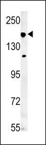 IFT172 Antibody - IFT172 Antibody western blot of mouse lung tissue lysates (35 ug/lane). The IFT172 antibody detected IFT172 protein (arrow).