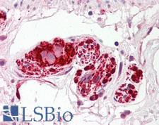 IFT172 Antibody - Anti-IFT172 antibody IHC of human colon, submucosal plexus. Immunohistochemistry of formalin-fixed, paraffin-embedded tissue after heat-induced antigen retrieval. Antibody dilution 2.5-5 ug/ml. This image was taken for the unconjugated form of this product. Other forms have not been tested.