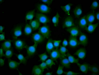 IFT172 Antibody - Immunofluorescence staining of A549 cells diluted at 1:133, counter-stained with DAPI. The cells were fixed in 4% formaldehyde, permeabilized using 0.2% Triton X-100 and blocked in 10% normal Goat Serum. The cells were then incubated with the antibody overnight at 4°C.The Secondary antibody was Alexa Fluor 488-congugated AffiniPure Goat Anti-Rabbit IgG (H+L).