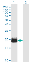 IFT20 Antibody - Western blot of IFT20 expression in transfected 293T cell line by IFT20 monoclonal antibody (M02), clone 3F3.