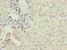 IFT20 Antibody - Immunohistochemistry of paraffin-embedded human liver cancer at dilution of 1:100