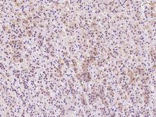 IFT20 Antibody - Immunochemical staining of human IFT20 in human adrenal gland with rabbit polyclonal antibody at 1:1000 dilution, formalin-fixed paraffin embedded sections.