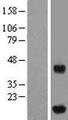 IFT20 Protein - Western validation with an anti-DDK antibody * L: Control HEK293 lysate R: Over-expression lysate