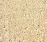 IFT22 / RABL5 Antibody - Immunohistochemistry of paraffin-embedded human adrenal gland tissue using IFT22 Antibody at dilution of 1:100