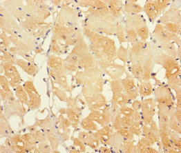 IFT22 / RABL5 Antibody - Immunohistochemistry of paraffin-embedded human heart tissue using IFT22 Antibody at dilution of 1:100