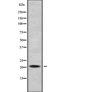 IFT22 / RABL5 Antibody - Western blot analysis of RABL5 using A549 whole cells lysates