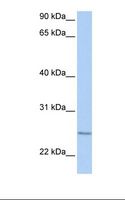 IFT27 / RABL4 Antibody - 721_B cell lysate. Antibody concentration: 1.0 ug/ml. Gel concentration: 12%.  This image was taken for the unconjugated form of this product. Other forms have not been tested.