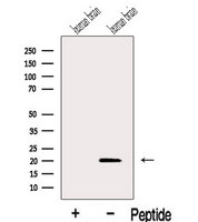 IFT27 / RABL4 Antibody - Western blot analysis of extracts of human brain tissue using IFT27 antibody. The lane on the left was treated with blocking peptide.