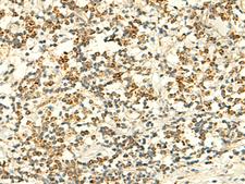 IFT27 / RABL4 Antibody - Immunohistochemistry of paraffin-embedded Human tonsil tissue  using IFT27 Polyclonal Antibody at dilution of 1:50(×200)