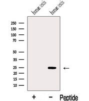 IFT43 / C14orf179 Antibody - Western blot analysis of extracts of human testis tissue using IFT43 antibody. The lane on the left was treated with blocking peptide.