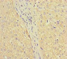 IFT46 Antibody - Immunohistochemistry of paraffin-embedded human liver tissue at dilution of 1:100