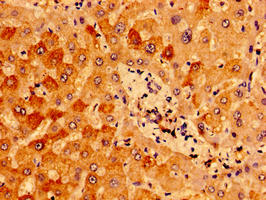 IFT46 Antibody - Immunohistochemistry of paraffin-embedded human liver tissue using IFT46 Antibody at dilution of 1:100