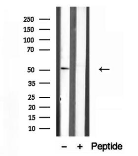 IFT52 Antibody - Western blot analysis of extracts of mouse testis tissue using IFT52 antibody.