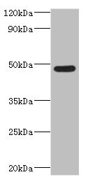 IFT57 / HIPPI Antibody - Western blot All lanes: IFT57 antibody at 2µg/ml + Mouse lung tissue Secondary Goat polyclonal to rabbit IgG at 1/10000 dilution Predicted band size: 49 kDa Observed band size: 49 kDa