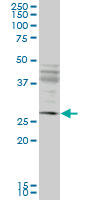 IFT57 / HIPPI Antibody - IFT57 monoclonal antibody (M02), clone 1G8. Western blot of IFT57 expression in Jurkat.