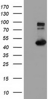IFT57 / HIPPI Antibody - HEK293T cells were transfected with the pCMV6-ENTRY control (Left lane) or pCMV6-ENTRY IFT57 (Right lane) cDNA for 48 hrs and lysed. Equivalent amounts of cell lysates (5 ug per lane) were separated by SDS-PAGE and immunoblotted with anti-IFT57.