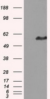 IFT57 / HIPPI Antibody - HEK293T cells were transfected with the pCMV6-ENTRY control (Left lane) or pCMV6-ENTRY IFT57 (Right lane) cDNA for 48 hrs and lysed. Equivalent amounts of cell lysates (5 ug per lane) were separated by SDS-PAGE and immunoblotted with anti-IFT57.
