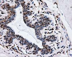 IFT57 / HIPPI Antibody - IHC of paraffin-embedded breast tissue using anti-IFT57 mouse monoclonal antibody. (Dilution 1:50).