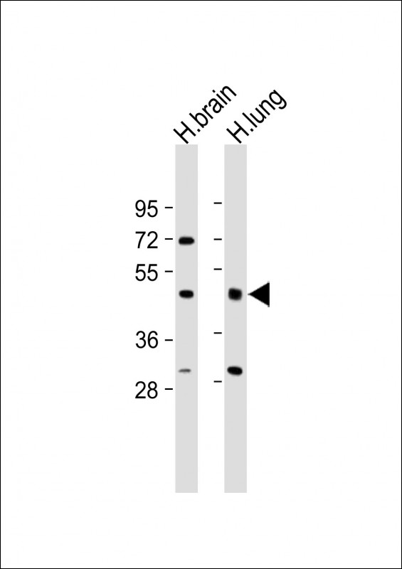 IFT57 / HIPPI Antibody - All lanes: Anti-IFT57 Antibody (Center) at 1:2000 dilution Lane 1: Human brain lysate Lane 2: Human lung lysate Lysates/proteins at 20 µg per lane. Secondary Goat Anti-Rabbit IgG, (H+L), Peroxidase conjugated at 1/10000 dilution. Predicted band size: 49 kDa Blocking/Dilution buffer: 5% NFDM/TBST.