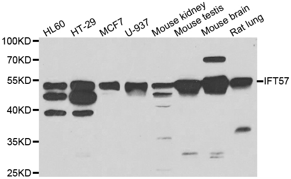 IFT57 / HIPPI Antibody - Western blot analysis of extracts of various cell lines.