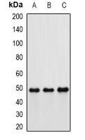 IFT57 / HIPPI Antibody - Western blot analysis of Hippi expression in MCF7 (A); mouse kidney (B); rat lung (C) whole cell lysates.