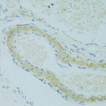 IFT57 / HIPPI Antibody - Immunohistochemistry of paraffin-embedded rat ovary using IFT57 antibody at dilution of 1:100 (40x lens).