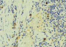 IFT57 / HIPPI Antibody - 1:100 staining human lymph tissue by IHC-P. The sample was formaldehyde fixed and a heat mediated antigen retrieval step in citrate buffer was performed. The sample was then blocked and incubated with the antibody for 1.5 hours at 22°C. An HRP conjugated goat anti-rabbit antibody was used as the secondary.
