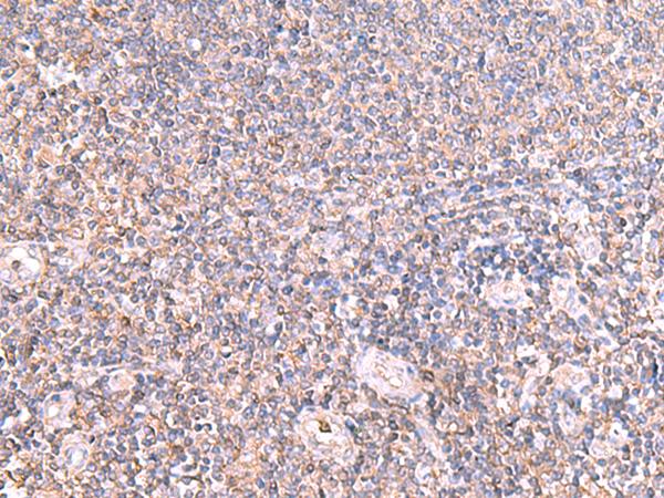 IFT57 / HIPPI Antibody - Immunohistochemistry of paraffin-embedded Human tonsil tissue  using IFT57 Polyclonal Antibody at dilution of 1:85(×200)