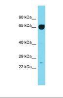 IFT74 / CCDC2 Antibody - Western blot of Rat Lung . Ift74 antibody dilution 1.0 ug/ml.  This image was taken for the unconjugated form of this product. Other forms have not been tested.