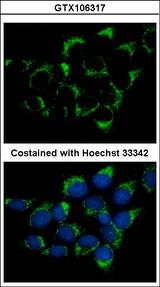IFT74 / CCDC2 Antibody - Immunofluorescence of methanol-fixed A431 using CMG1 antibody at 1:500 dilution.