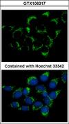 IFT74 / CCDC2 Antibody - Immunofluorescence of methanol-fixed A431 using CMG1 antibody at 1:500 dilution.