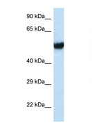 IFT74 / CCDC2 Antibody - IFT74 antibody Western blot of MCF7 Cell lysate. Antibody concentration 1 ug/ml.  This image was taken for the unconjugated form of this product. Other forms have not been tested.