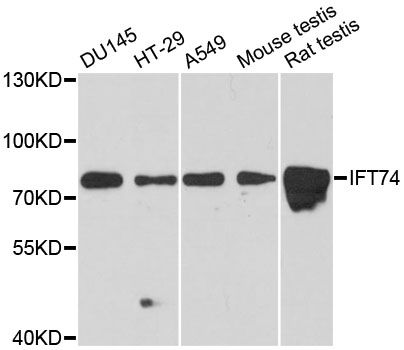 IFT74 / CCDC2 Antibody - Western blot analysis of extracts of various cell lines, using IFT74 antibody at 1:3000 dilution. The secondary antibody used was an HRP Goat Anti-Rabbit IgG (H+L) at 1:10000 dilution. Lysates were loaded 25ug per lane and 3% nonfat dry milk in TBST was used for blocking. An ECL Kit was used for detection and the exposure time was 90s.