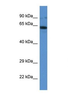 IFT80 Antibody - IFT80 antibody Western blot of Mouse Spleen lysate. Antibody concentration 1 ug/ml. This image was taken for the unconjugated form of this product. Other forms have not been tested.