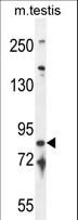 IFT81 Antibody - IFT81 Antibody western blot of mouse testis tissue lysates (35 ug/lane). The IFT81 antibody detected the IFT81 protein (arrow).