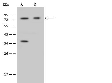 IFT81 Antibody - Anti-IFT81 rabbit polyclonal antibody at 1:500 dilution. Lane A: U-251MG Whole Cell Lysate. Lane B: NIH-3T3 Whole Cell Lysate. Lysates/proteins at 30 ug per lane. Secondary: Goat Anti-Rabbit IgG (H+L)/HRP at 1/10000 dilution. Developed using the ECL technique. Performed under reducing conditions. Predicted band size: 79 kDa. Observed band size: 79 kDa.
