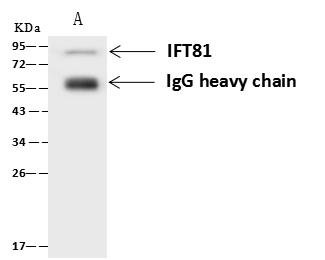 IFT81 Antibody - IFT81 was immunoprecipitated using: Lane A: 0.5 mg U-251MG Whole Cell Lysate. 4 uL anti-IFT81 rabbit polyclonal antibody and 60 ug of Immunomagnetic beads Protein A/G. Primary antibody: Anti-IFT81 rabbit polyclonal antibody, at 1:100 dilution. Secondary antibody: Goat Anti-Rabbit IgG (H+L)/HRP at 1/10000 dilution. Developed using the ECL technique. Performed under reducing conditions. Predicted band size: 79 kDa. Observed band size: 79 kDa.