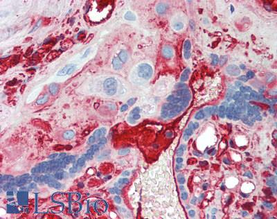 IgA1 Antibody - Human Placenta: Formalin-Fixed, Paraffin-Embedded (FFPE)